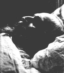 Napoléon III sur son lit de mort. Photo Mrs Downey